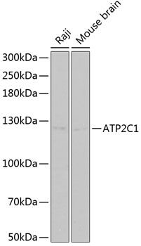 ATP2C1 Rabbit Polyclonal Antib