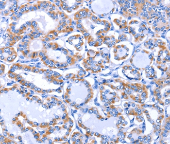 GJB3 Antibody[35700]