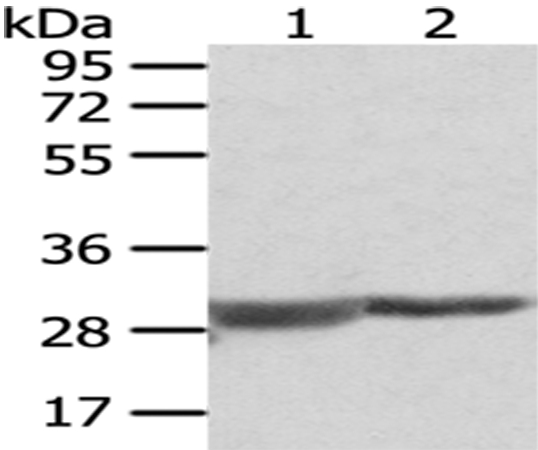 COMT Antibody[43047]