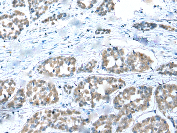 COMMD6 Antibody[42937]