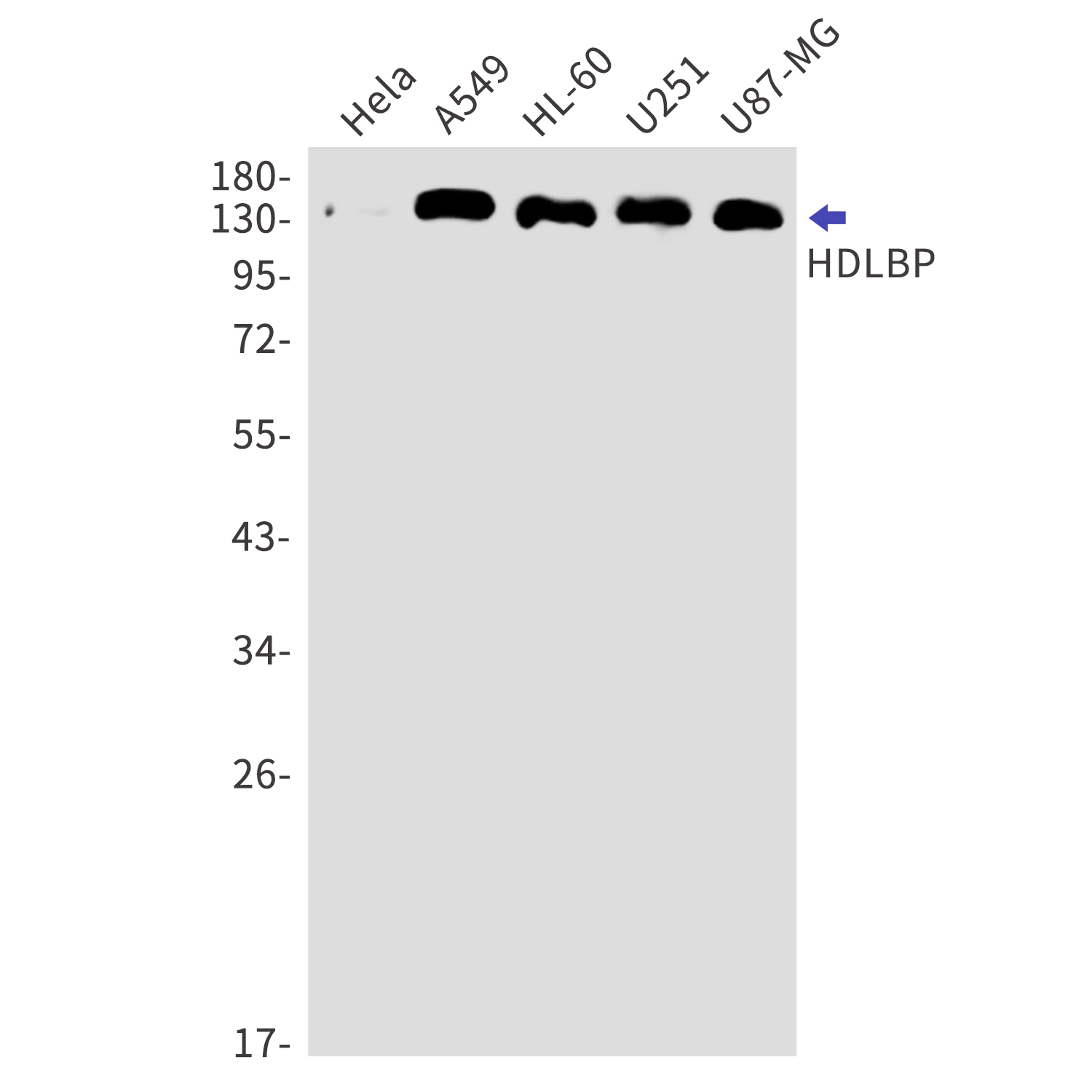 HDLBP Rabbit mAb[52770]