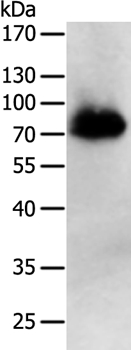 PRMT7 Antibody[35889]