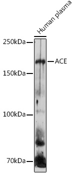 ACE Rabbit Polyclonal Antibody