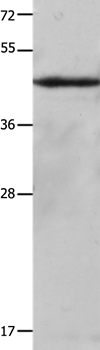 KRT23 Antibody[35632]