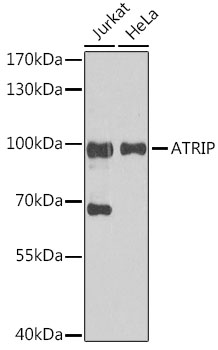 ATRIP Rabbit Polyclonal Antibo
