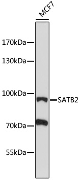 SATB2 Rabbit Polyclonal Antibo