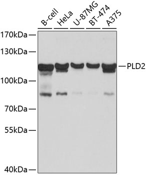 PLD2 Rabbit Polyclonal Antibod