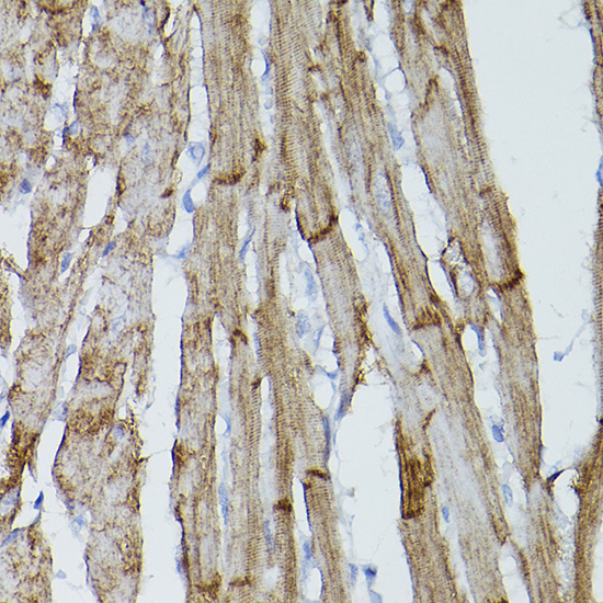 PDGFRA antibody[38364]