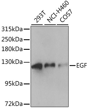 EGF Rabbit Polyclonal Antibody