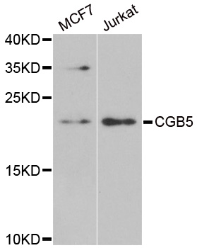 CGB5 antibody[38958]