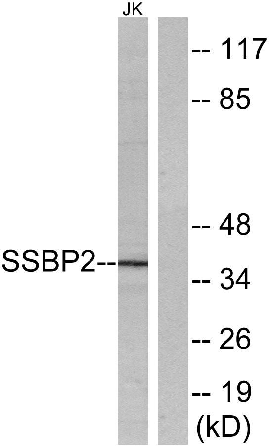 SSBP2 Polyclonal Antibody[6201