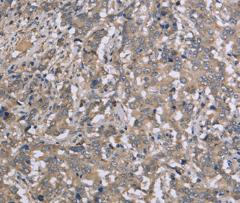 DTNB Antibody[36425]