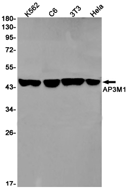 AP3M1 Rabbit mAb[52148]