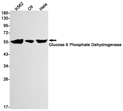 Glucose 6 Phosphate Dehydrogen