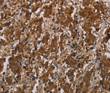 FGF20 Antibody[37573]