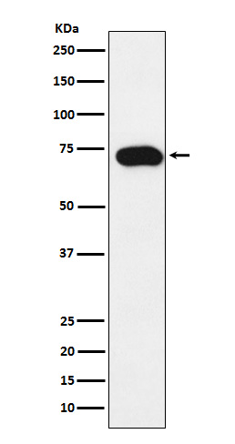 SLC22A1 Rabbit mAb[56609]