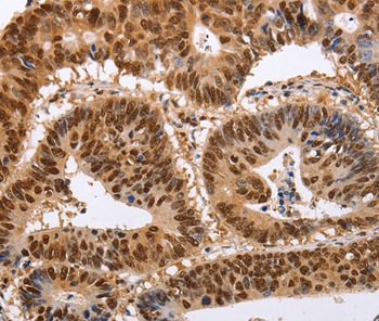 PSMD8 Antibody[35895]