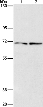 IFT74 Antibody[37493]