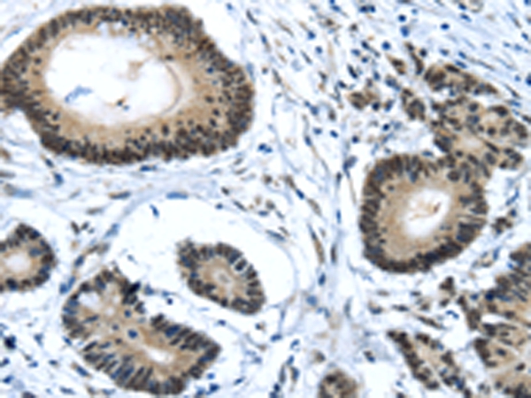 MED4 Antibody[43340]