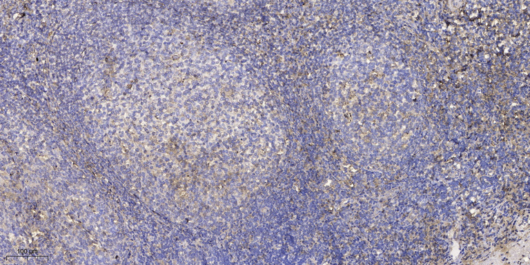 ZFP598 (phospho-Tyr306) Polycl