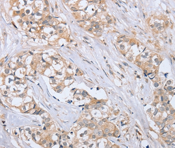 PTPN4 Antibody[37851]