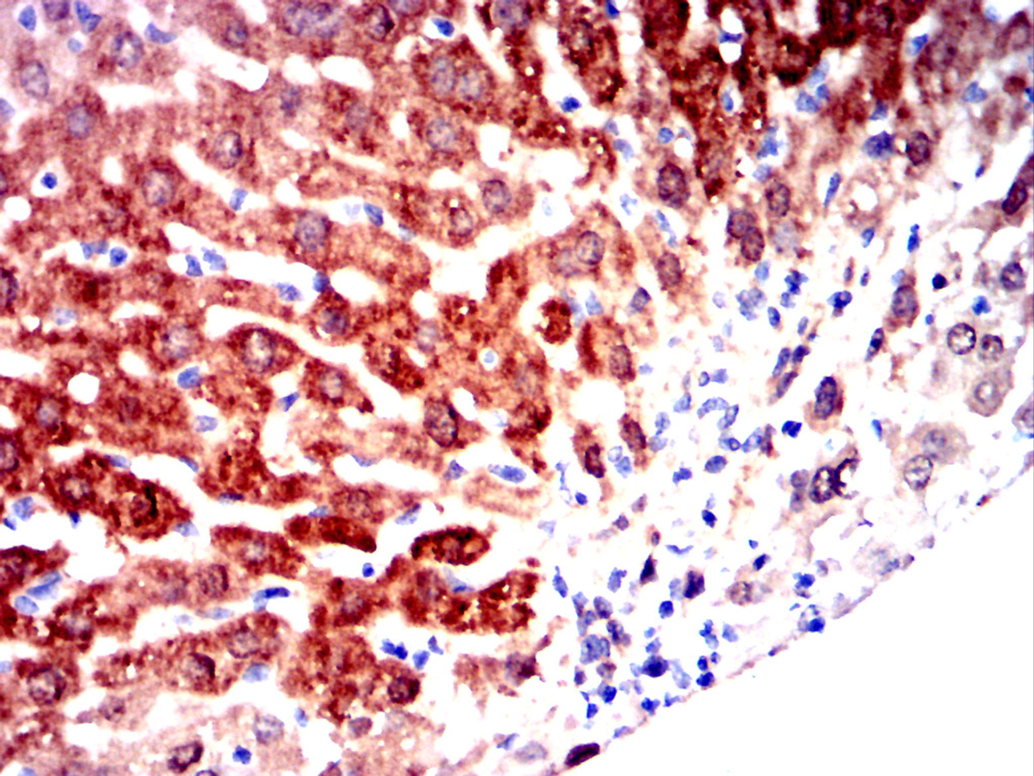 AKR1C1 Mouse mAb[63040]