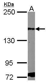 PDGF Receptor alpha Antibody[3