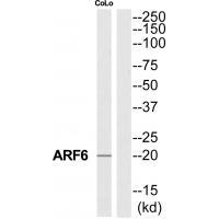 ARF6 Antibody[34392]