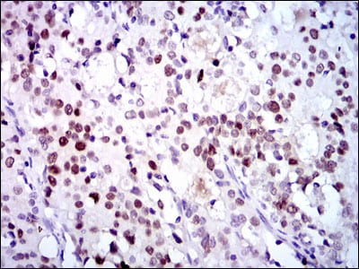 CDK2 Mouse mAb[63446]