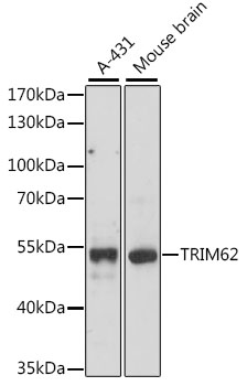 TRIM62 Rabbit Polyclonal Antib