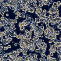 浙江（杭州）美森 人子宫内膜癌细胞RL-95-1（Luc1）现货