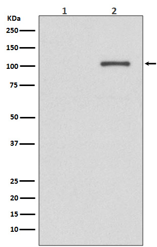 IRE1 (Phospho-Ser724) Rabbit m