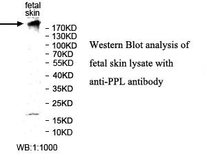 PPL Antibody[39987]