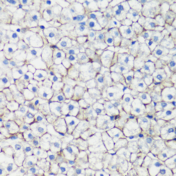 E-Cadherin Rabbit Polyclonal A