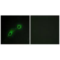 CAMK5 Antibody[33970]