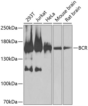 BCR Rabbit Polyclonal Antibody