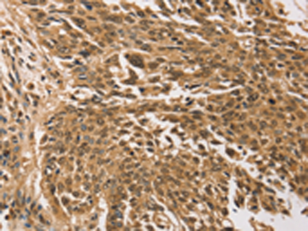 TGM7 Antibody[43168]