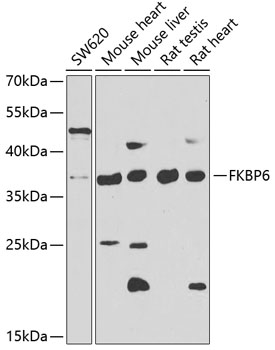 FKBP6 Rabbit Polyclonal Antibo