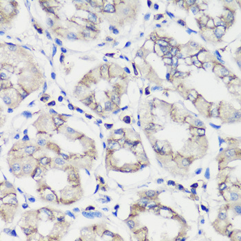 E-Cadherin Rabbit Polyclonal A