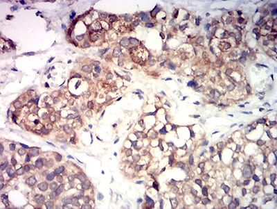 KMT5A Mouse mAb[63841]