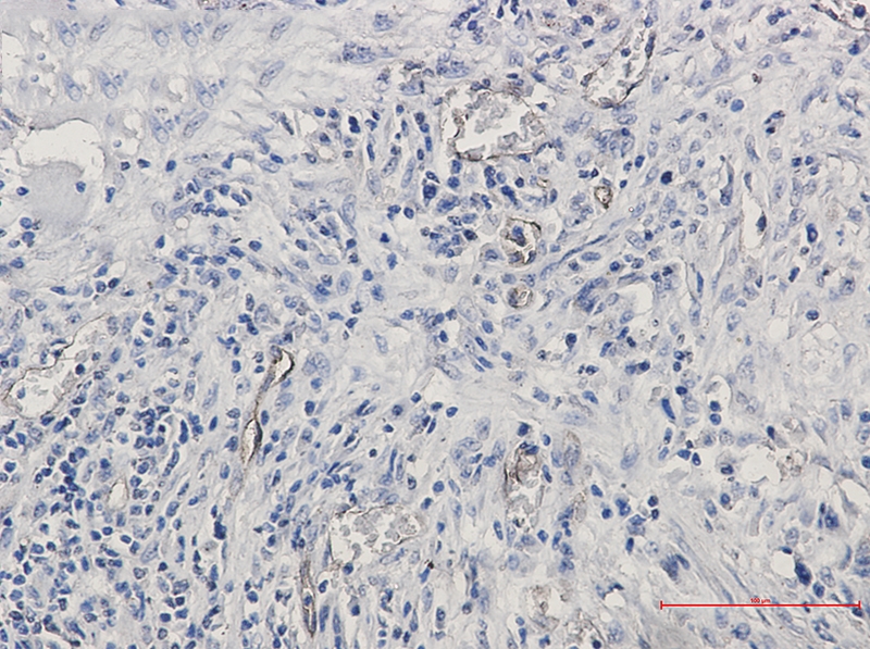 CD105 Rabbit mAb[52734]