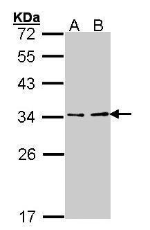 ATP6V1E1 Antibody[35378]
