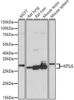 KITLG Rabbit Polyclonal Antibo