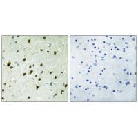 MAD4 Antibody[33882]