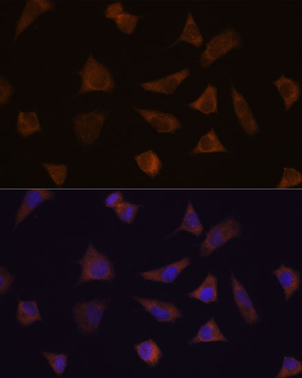 ENAH Rabbit Polyclonal Antibod