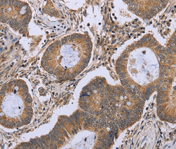 FKBP8 Antibody[36485]