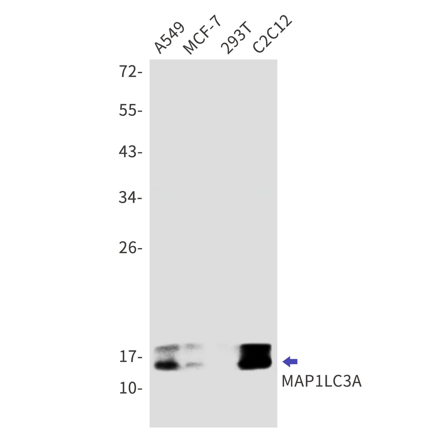 LC3A Rabbit mAb[52795]