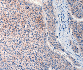 FAT4 Antibody[37293]