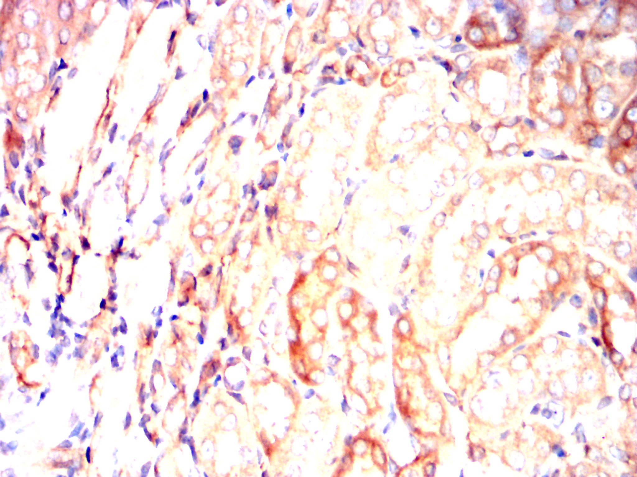 SERPINE1 Mouse mAb[64224]