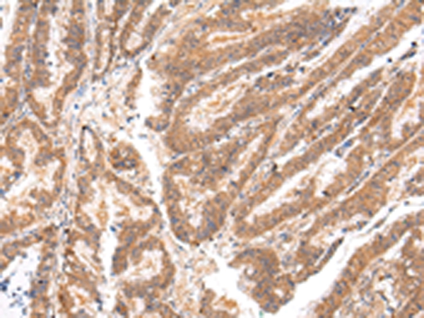 ATP7B  Antibody[43445]